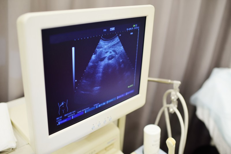 Bezpieczeństwo wykorzystania ultrasonografii podczas ciąży